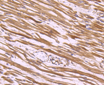 CLOCK Recombinant Rabbit Monoclonal Antibody