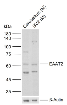 EAAT2 Rabbit Polyclonal Antibody