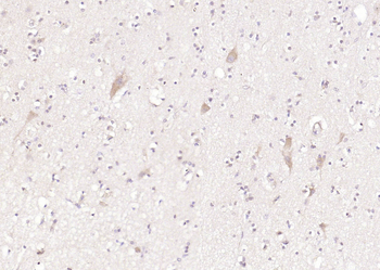 LIFR Rabbit Polyclonal Antibody