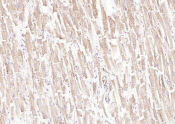 LIFR Rabbit Polyclonal Antibody