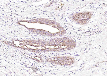 RIPK1 Rabbit Polyclonal Antibody