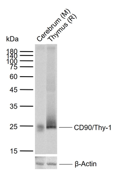 CD90/Thy-1 Recombinant Rabbit Monoclonal Antibody