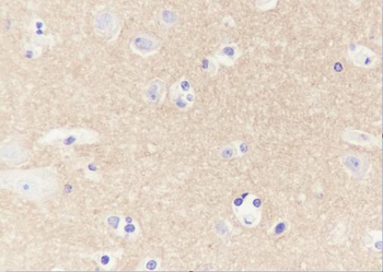 CD90/Thy-1 Recombinant Rabbit Monoclonal Antibody