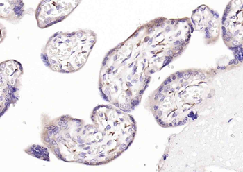 TGF beta Receptor II Rabbit Polyclonal Antibody