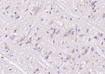 Plexin A1 Rabbit Polyclonal Antibody
