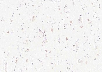 TMEM106B Rabbit Polyclonal Antibody