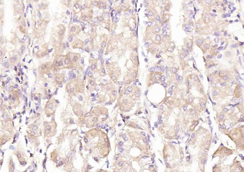 TMEM106B Rabbit Polyclonal Antibody