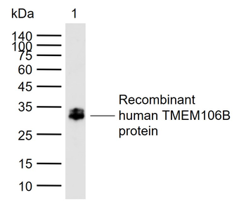 TMEM106B Rabbit Polyclonal Antibody