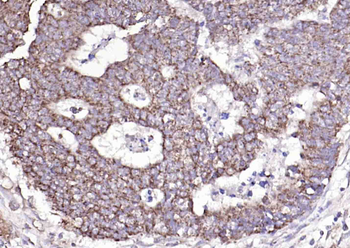 Cytokeratin 8 Rabbit Polyclonal Antibody