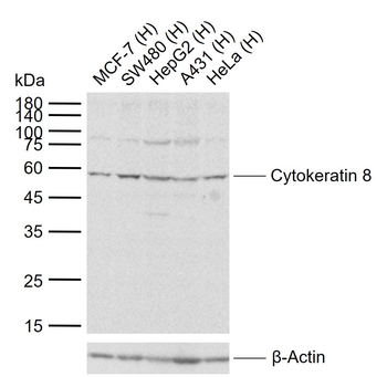 Cytokeratin 8 Rabbit Polyclonal Antibody