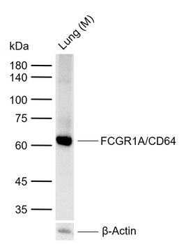 FCGR1A/CD64 Rabbit Polyclonal Antibody