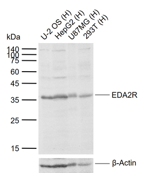 EDA2R Rabbit Polyclonal Antibody