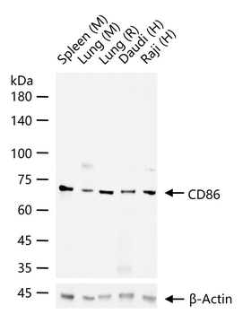 CD86 Recombinant Rabbit Monoclonal Antibody