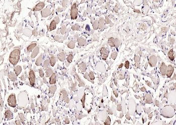 Myoglobin Mouse Monoclonal Antibody