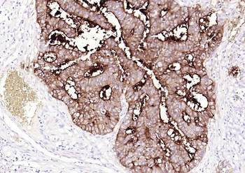 CEACAM5 Mouse Monoclonal Antibody