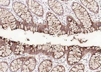 CEACAM5 Mouse Monoclonal Antibody