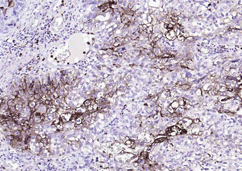 CEACAM5 Mouse Monoclonal Antibody