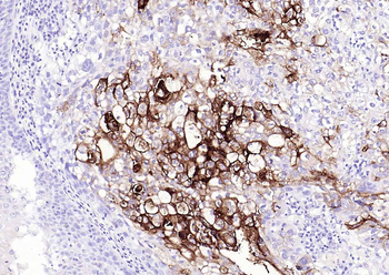 CEACAM5 Mouse Monoclonal Antibody