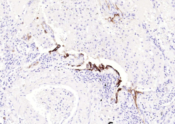 CEACAM5 Mouse Monoclonal Antibody