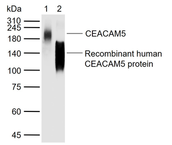 CEACAM5 Mouse Monoclonal Antibody