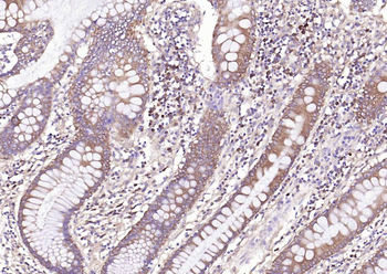 NME1/NM23A Rabbit Polyclonal Antibody