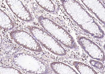 NME1/NM23A Rabbit Polyclonal Antibody