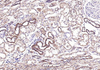 NME1/NM23A Rabbit Polyclonal Antibody
