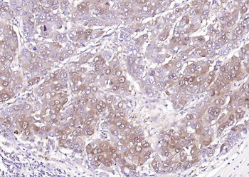 NME1/NM23A Rabbit Polyclonal Antibody