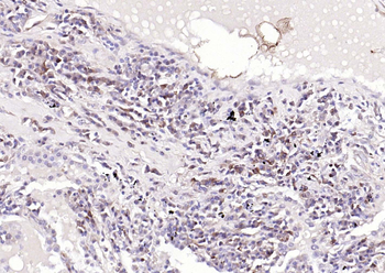 NME1/NM23A Rabbit Polyclonal Antibody