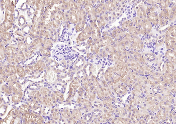 NME1/NM23A Rabbit Polyclonal Antibody