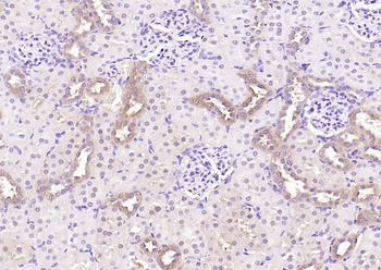 NME1/NM23A Rabbit Polyclonal Antibody
