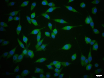 GRK2 Rabbit Polyclonal Antibody