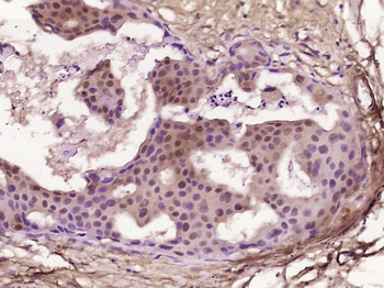 GRK2 Rabbit Polyclonal Antibody