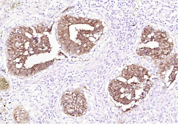 Villin Mouse Monoclonal Antibody