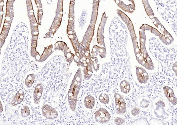 Villin Mouse Monoclonal Antibody