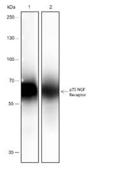 NGFR/p75NTR Recombinant Rabbit Monoclonal Antibody