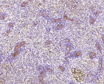 NGFR/p75NTR Recombinant Rabbit Monoclonal Antibody