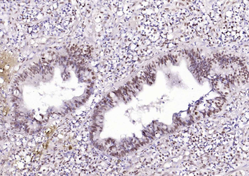 HNF1A Rabbit Polyclonal Antibody