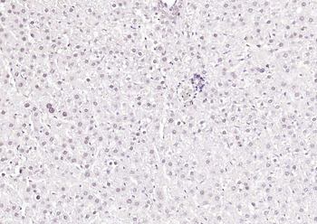HNF1A Rabbit Polyclonal Antibody
