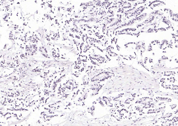 HNF1A Rabbit Polyclonal Antibody