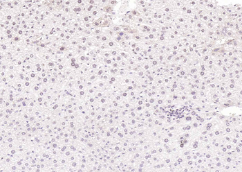 HNF1A Rabbit Polyclonal Antibody