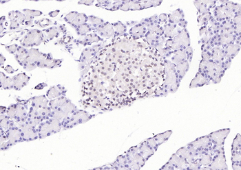 HNF1A Rabbit Polyclonal Antibody