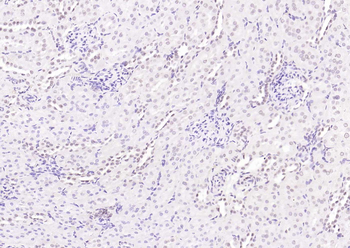 HNF1A Rabbit Polyclonal Antibody