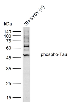 Phospho-Tau (Thr231) Mouse Monoclonal Antibody