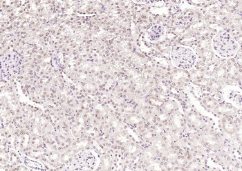 N-Myc Rabbit Polyclonal Antibody