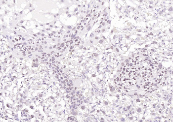 N-Myc Rabbit Polyclonal Antibody