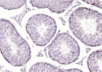 N-Myc Rabbit Polyclonal Antibody