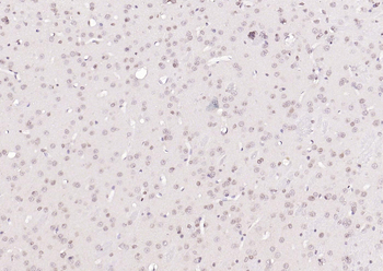 N-Myc Rabbit Polyclonal Antibody