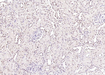 N-Myc Rabbit Polyclonal Antibody