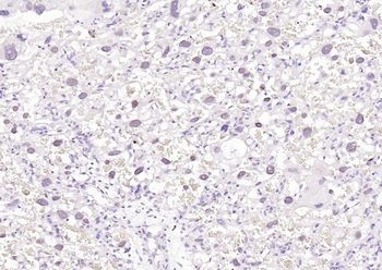 N-Myc Rabbit Polyclonal Antibody